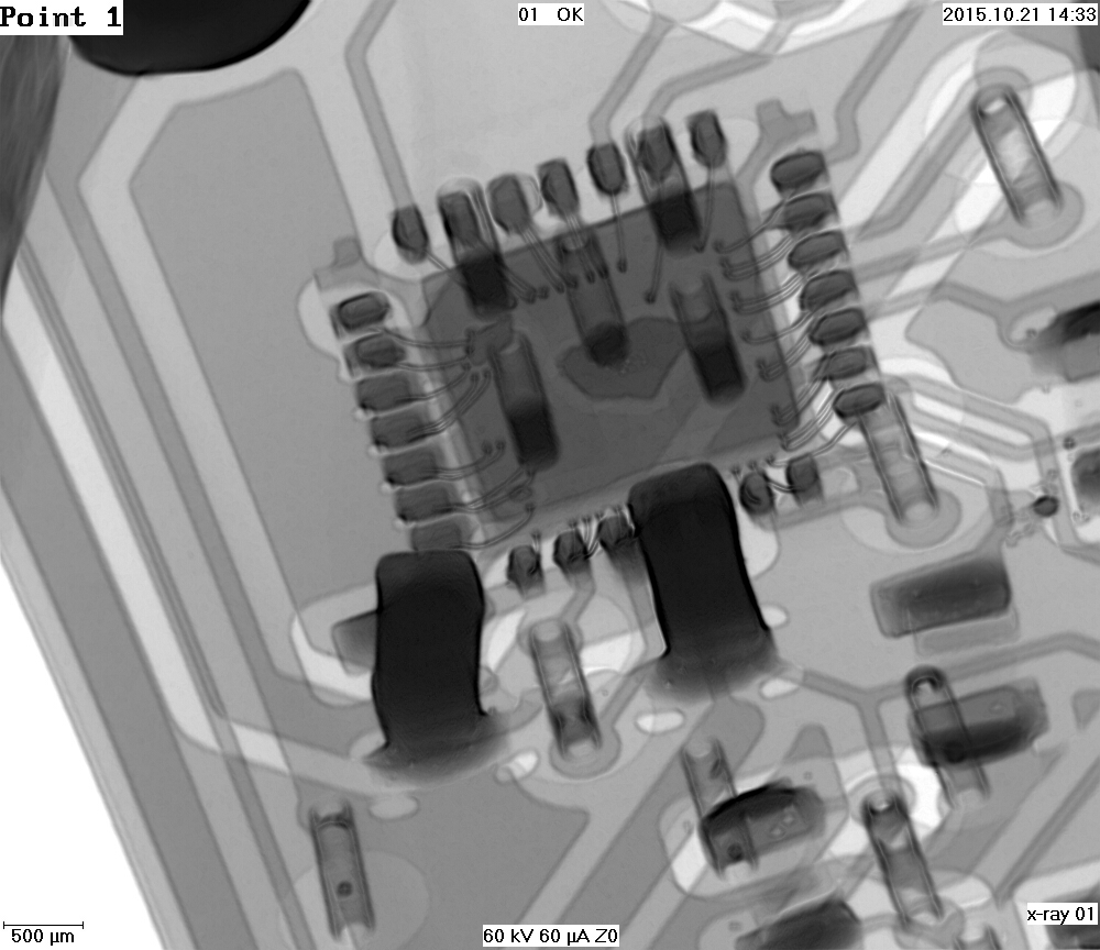 X ray of gamma board